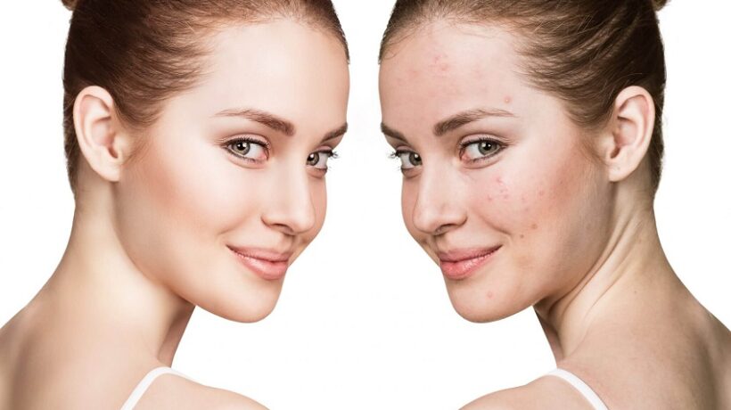 How Long Do Facials Last?