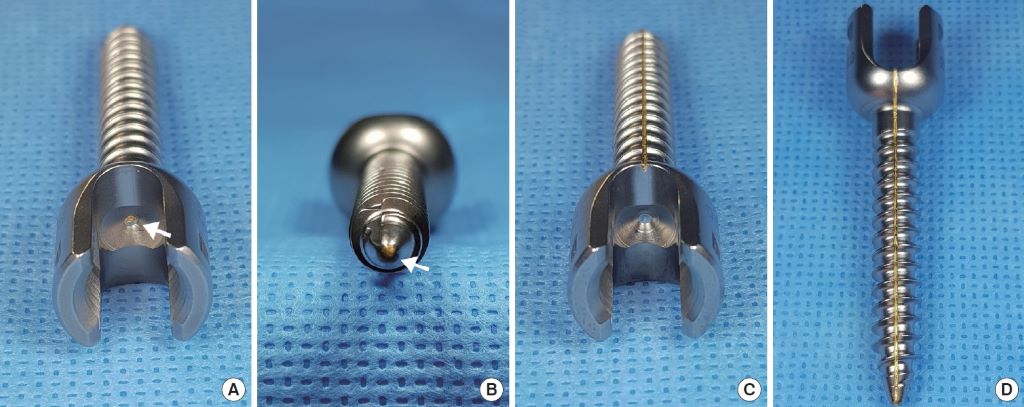 How Much Do Titanium Surgical Screws Weight? Unveiling the Weight of Medical Marvels
